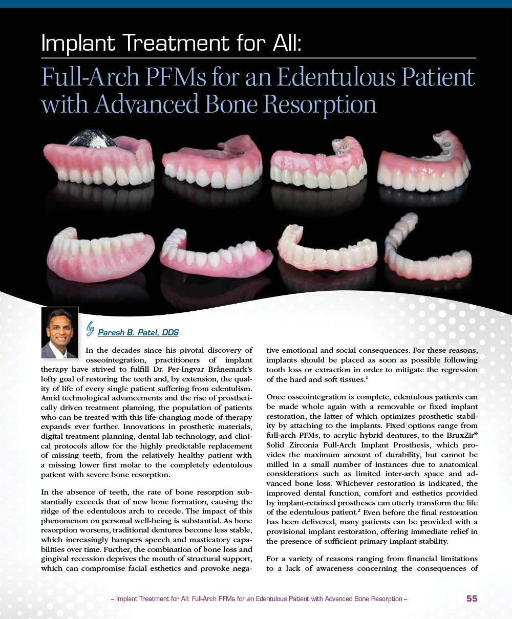 Implant Treatment for All: Full-Arch PFMs for an Edentulous Patient with Advanced Bone Resorption