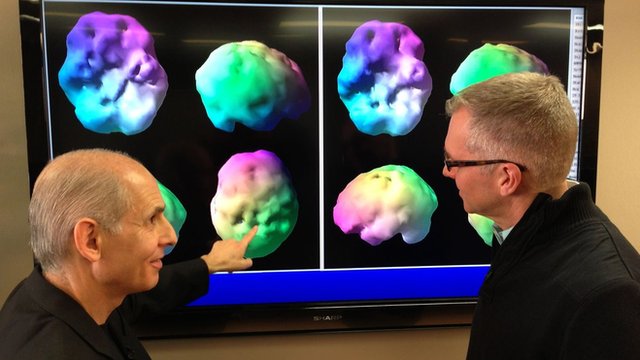 Dr. Daniel Amen and SPECT Imaging Brain Scans.