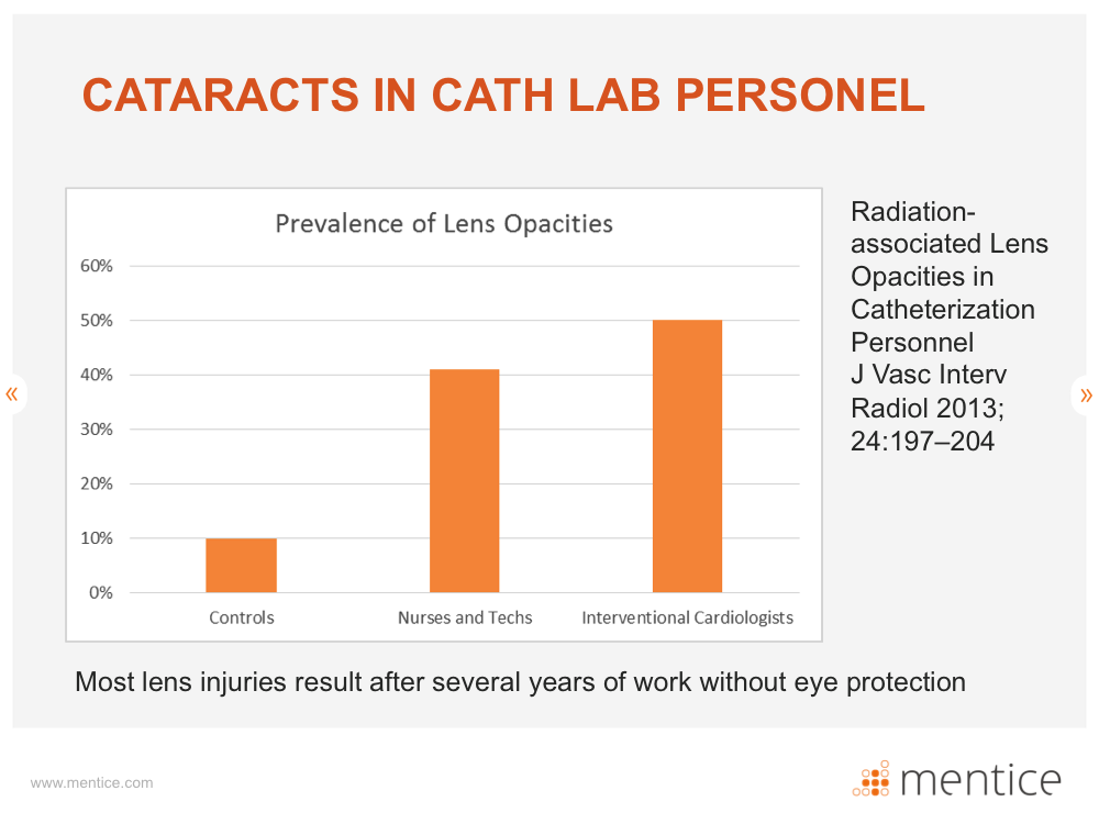 Cataracts in cath lab personel