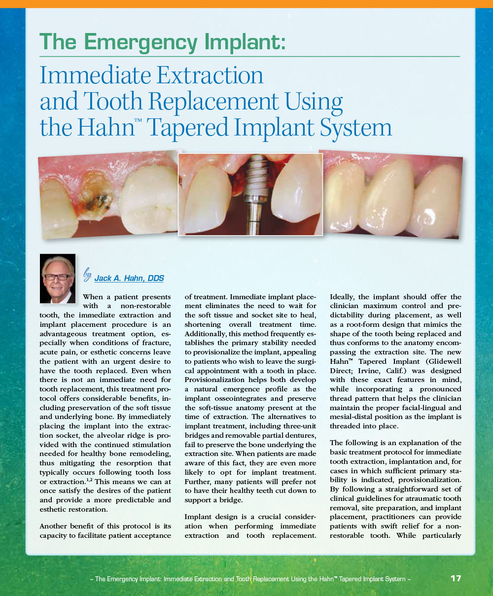 The Emergency Implant: Immediate Extraction and Tooth Replacement Using the Hahn™ Tapered Implant System