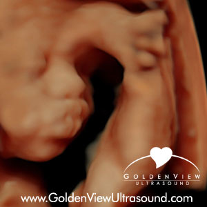 HD Live Ultrasound at 31 weeks