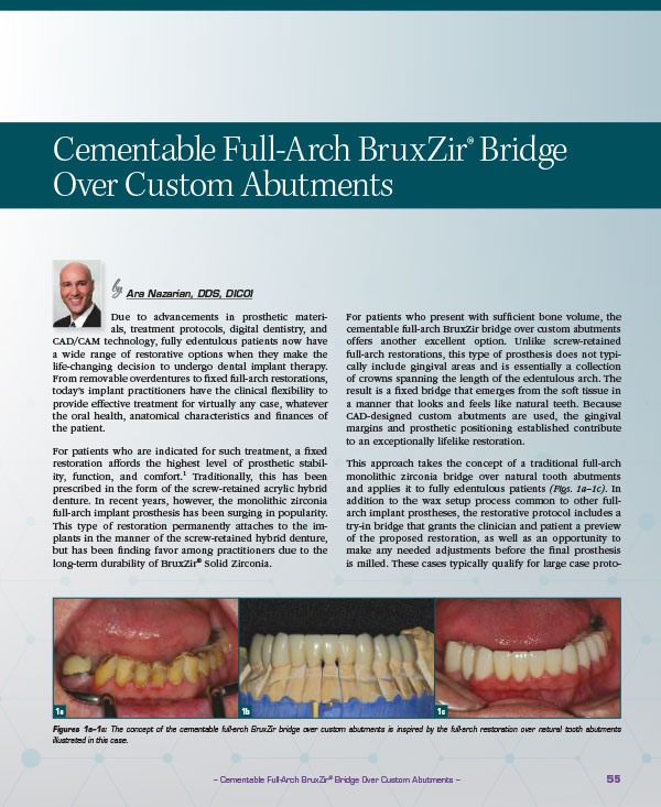 Cementable Full-Arch BruxZir® Bridge Over Custom Abutments