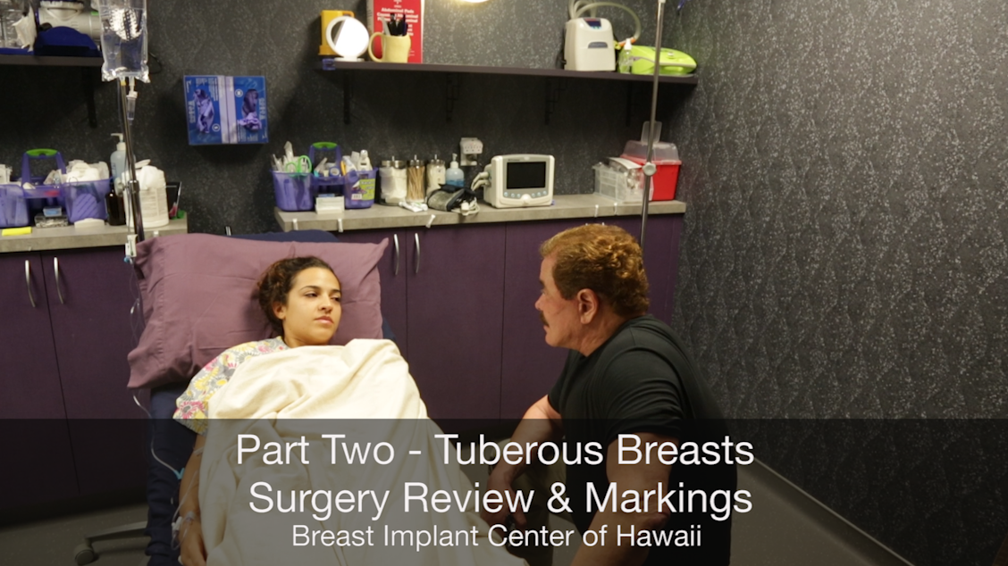 Tuberous Breasts: One Woman’s Plastic Surgery Journey to Reclaim her ...