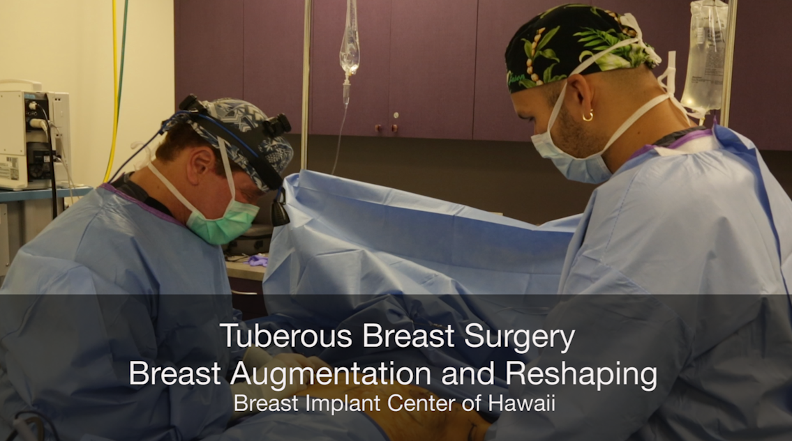 Tuberous Breasts: One Woman’s Plastic Surgery Journey to Reclaim her ...