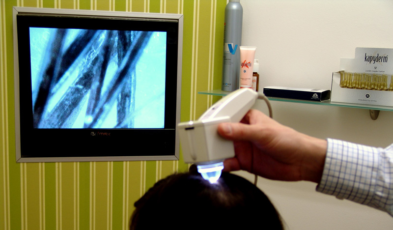 New Man Clinic - Kapyderm - Tehnical Dermotrichology Consultant performing a trichogram (hair and scalp examination using a microcamera)