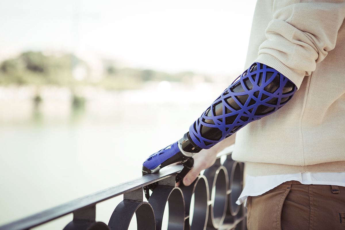 Unyq Launches First Collection Of 3d Printed Upper Limb Prosthetic Covers