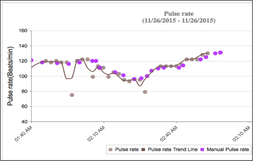 *Comparison of pulse readings made by an anesthesia monitor (purple dots) and the PetPace smart collar (brown dots) during Kira’s surgery.