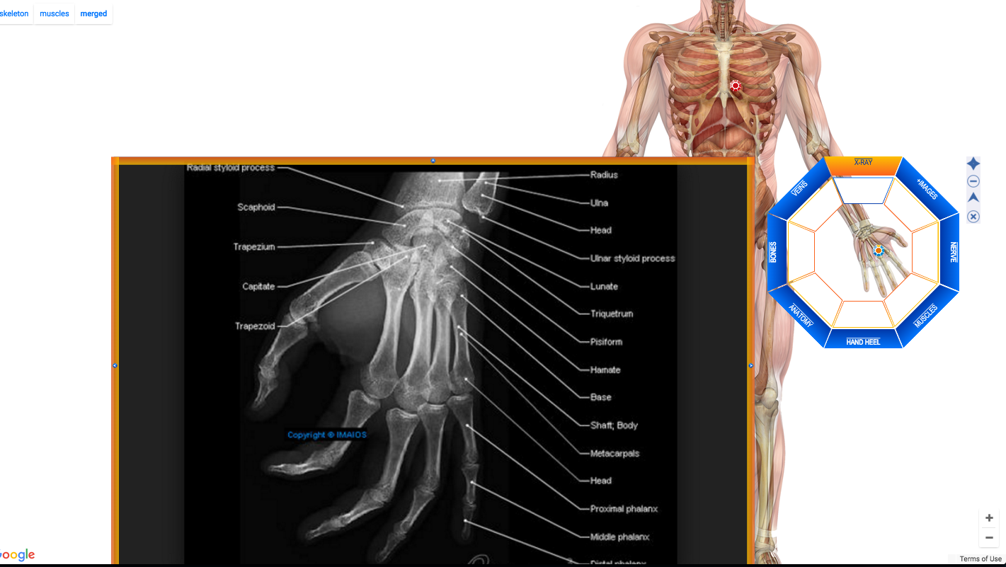 Mindports® Rich Overlays for Diagrams. Maps, Page