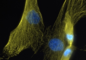 Human fibroblast (skin cells) undergoing cell division in culture in the lab of Tanja Dominko.