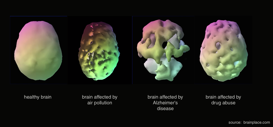 Damage of air pollution on the brain.