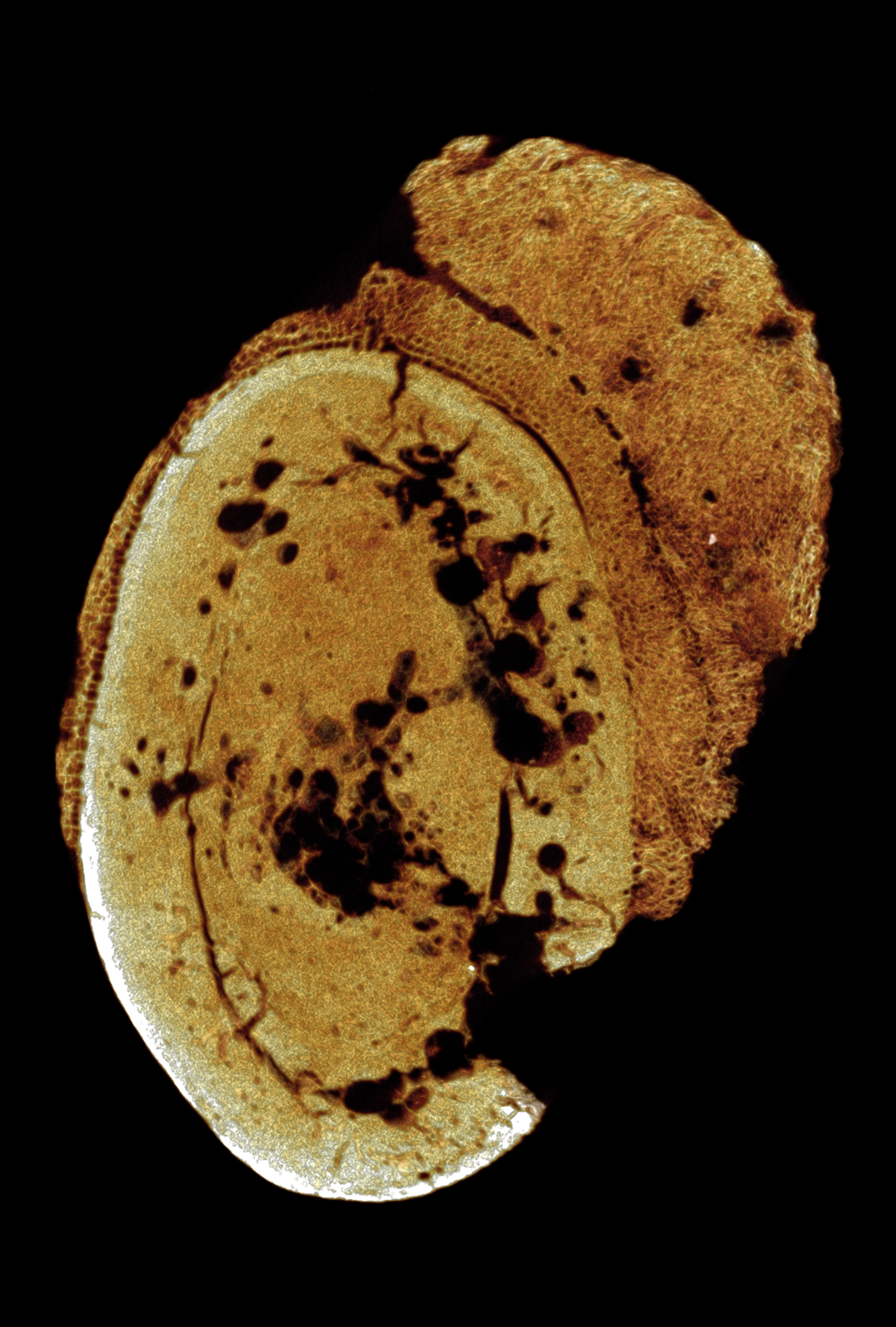 SK7923 fig 2. Metatarsal SK 7923. Transverse micro-CT orthoslice shows sclerotic cortical margin abutting the neoplasm. The sub-periosteal cortical invasion is clearly evident ventrally, with the medu