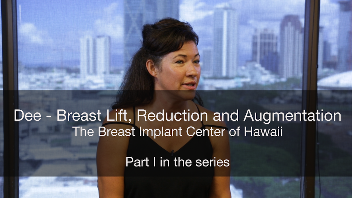 Breast Lift, Reduction & Augmentation Video Series - Part I