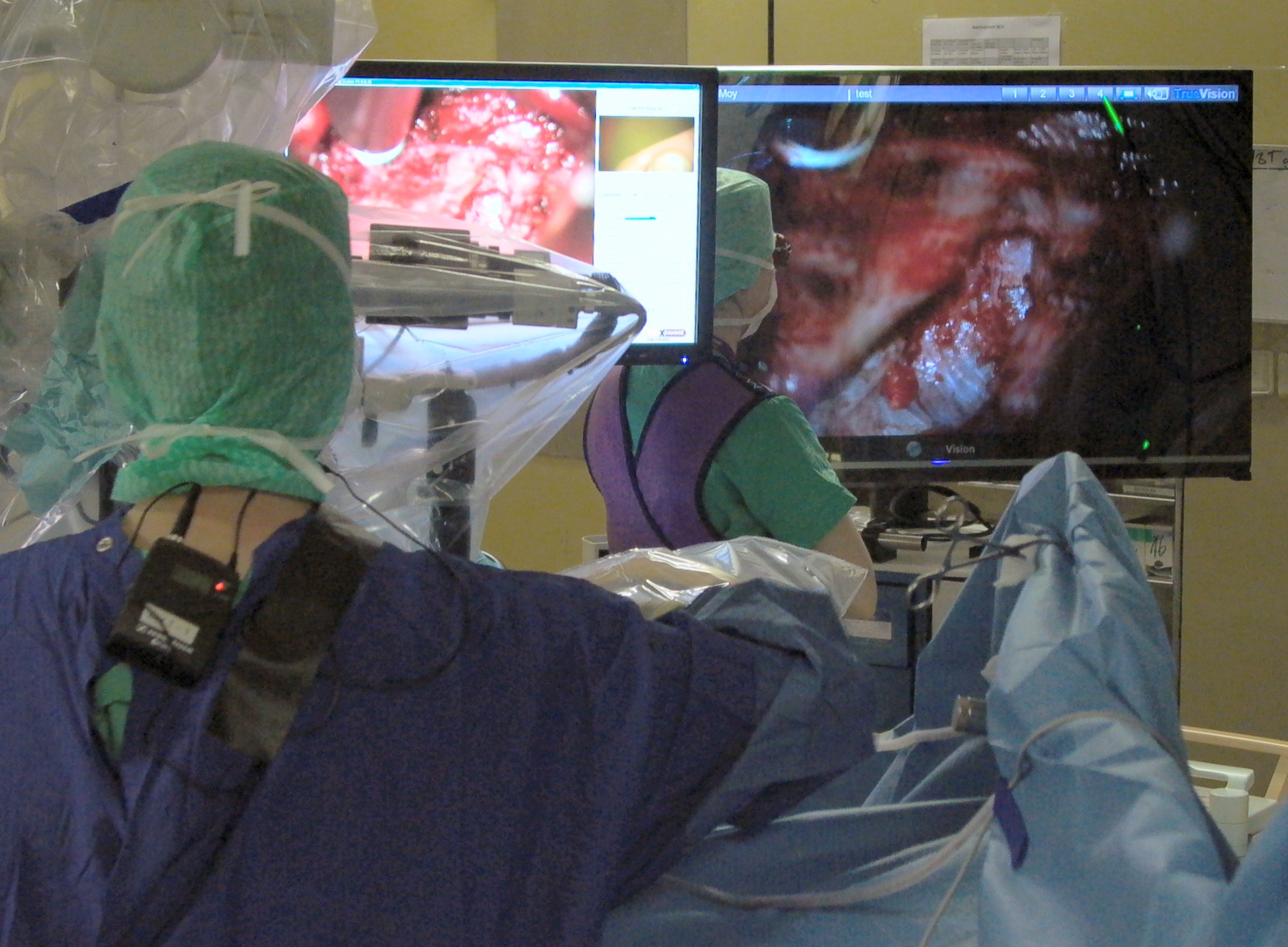 TrueVision 3D heads-up surgery for all surgical disciplines