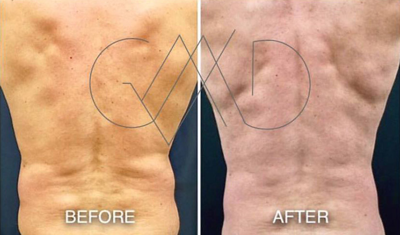 Dr. Vallecillos Before & After