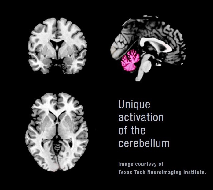 The study analyzed the brain maps generated by viewing four types of imagery - positive, negative, neutral, and Sky Factory's Open Sky Compositions.