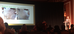 Dr. Ibrahim Presents about Juliet laser therapy's versatility at at a premier conference for aesthetics professionals.