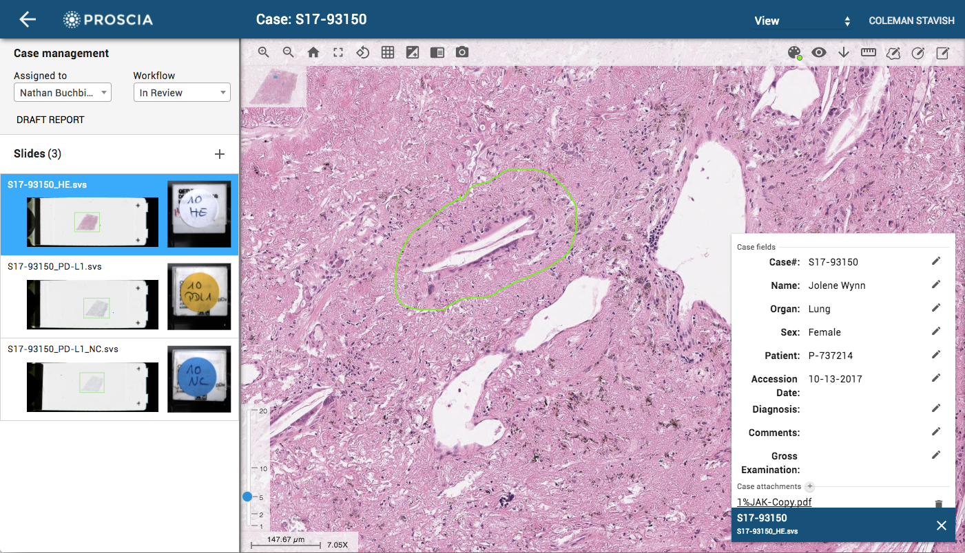 A pathologist reviews a case, including the whole slide image and associated metadata