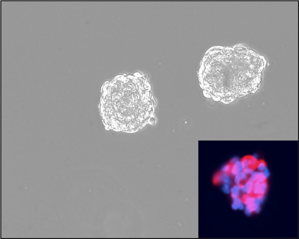 Bone marrow-derived MSC-NPs display spherical morphology as viewed by light microscopy.
