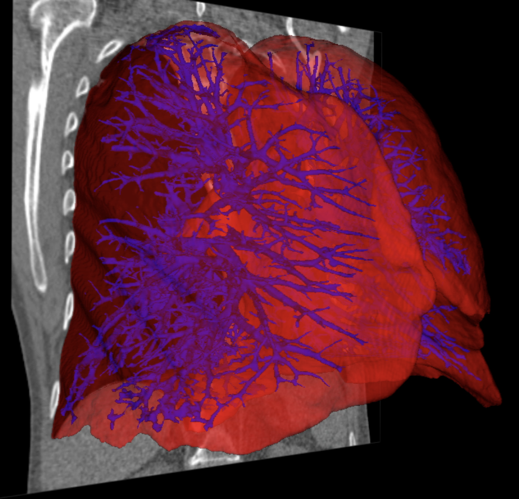 AI 3D organ segmentation - Lungs and vasculature