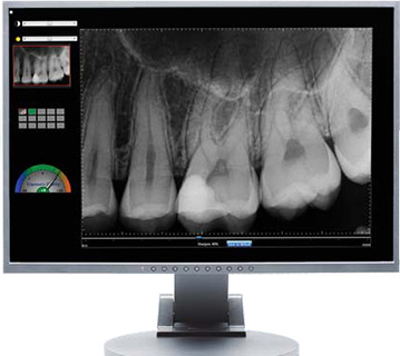 St. Lawrence Dentistry Digital Dental X-Ray Services