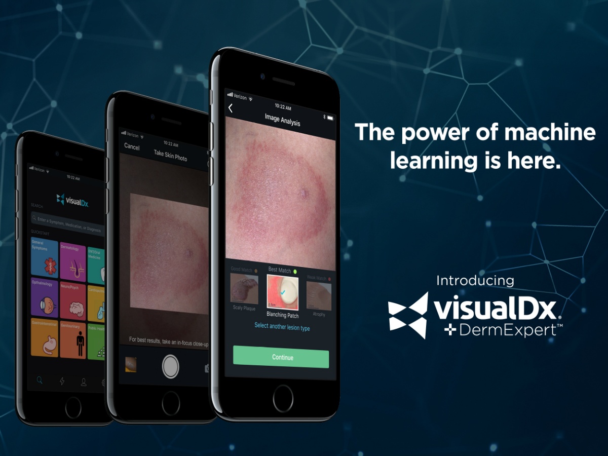 VisualDX is on the new frontier in healthcare – machine learning and vision science for more accurate diagnosis