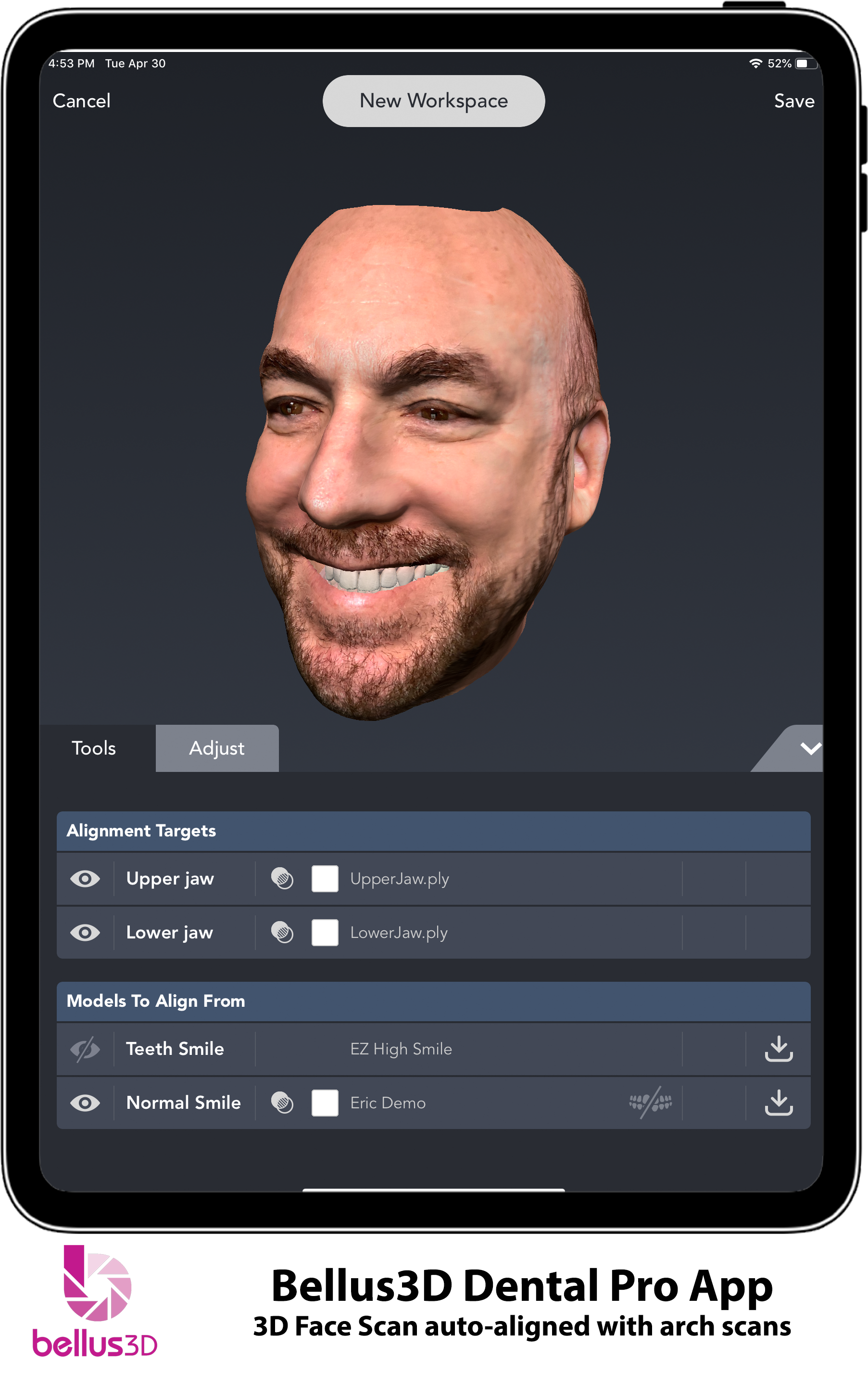 Bellus3D Dental Pro App with Dental Scan Alignment