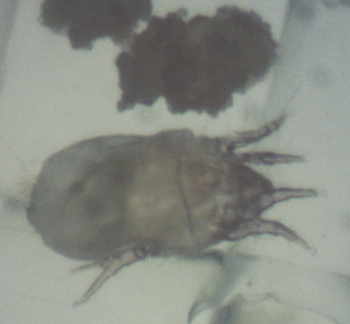 Dermatophagoides pteronyssinus.