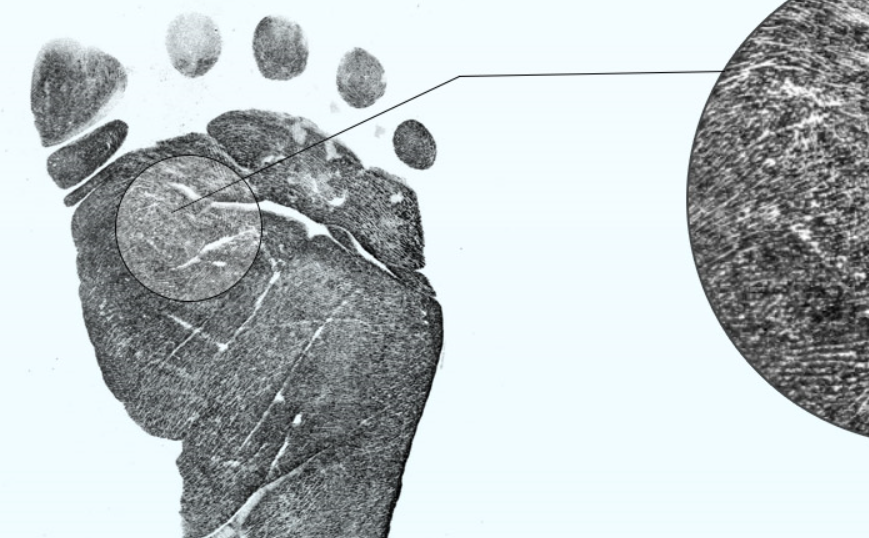 Infant Foot Ridge Detail