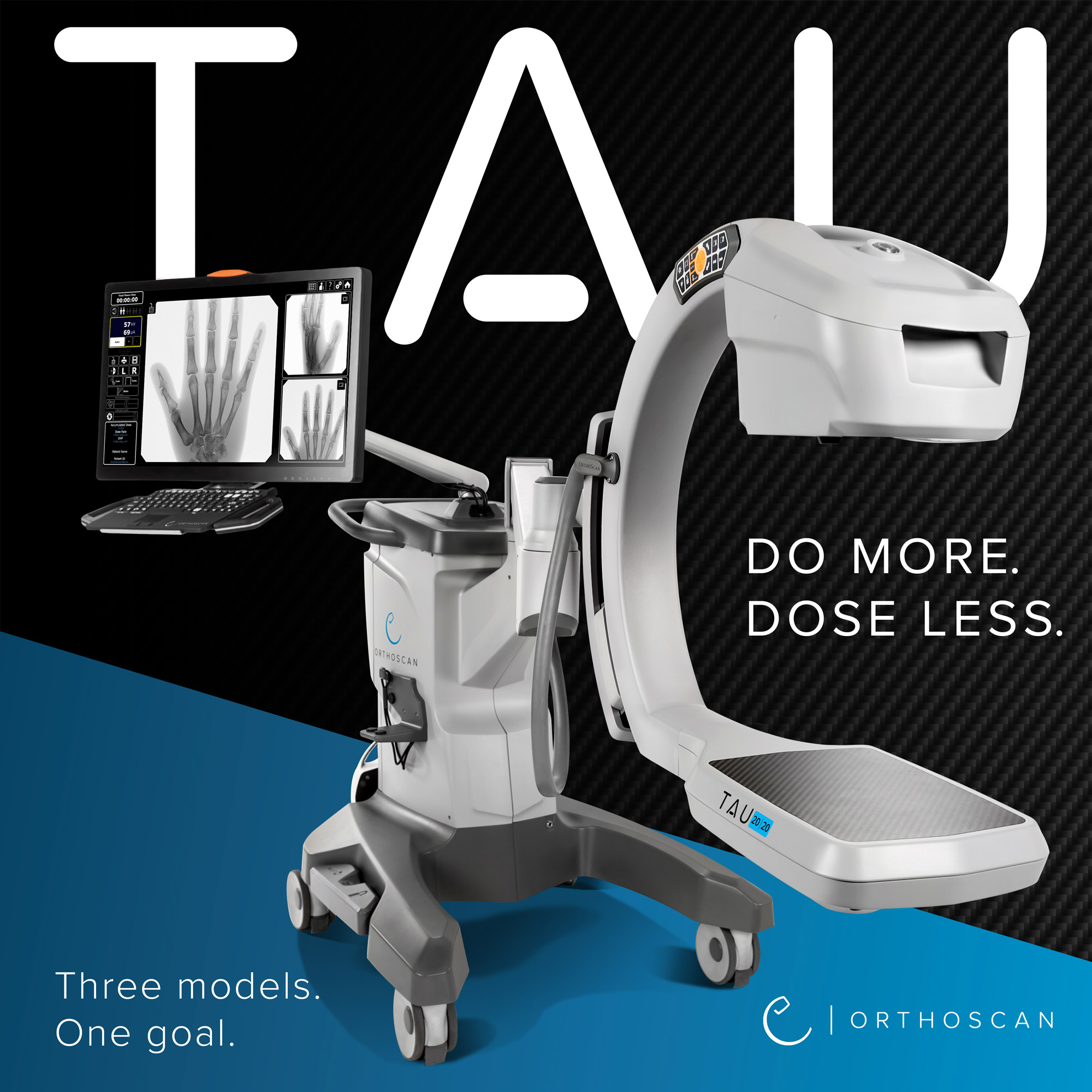 Introducing TAU, the newest member to the Orthoscan product line.