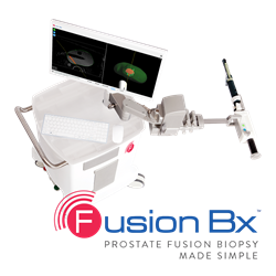 Fusion Bx Prostate Fusion Biopsy