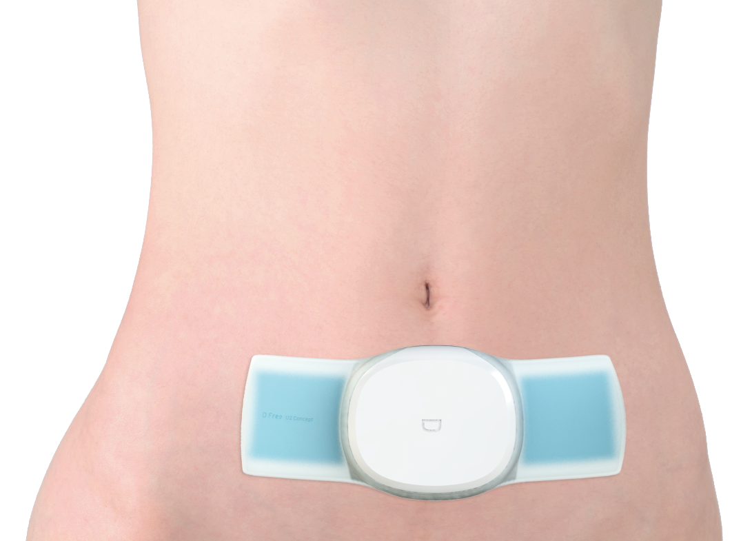 DFree® bowel sensor for bowel incontinence (product design concept).