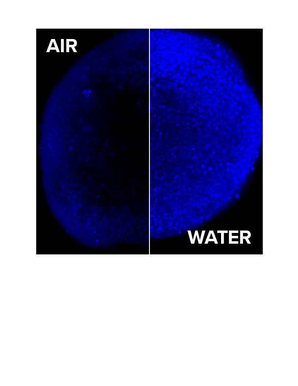 Gain up to 4 times more signal at depth using water immersion objectives on the ImageXpress Micro Confocal system