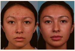 Cosmetic Facial Plastic Surgeon Dr. Ran Y. Rubinstein
