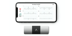 KardiaMobile 6L is a hand-held, patient-administered ECG device
