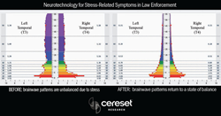 Graphs showing brain pattern changes before & after Cereset’s legacy neuromodulation technology is used for stress-related symptoms in law enforcement.