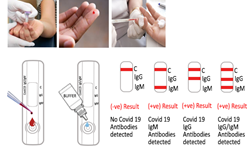 Covid 19 Rapid Test