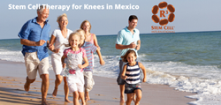 Stem Cell Therapy for Knees in Mexico