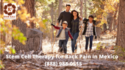 Stem Cell Therapy for Back Pain in Mexico