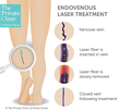 evla varicose vein treatment the private clinic