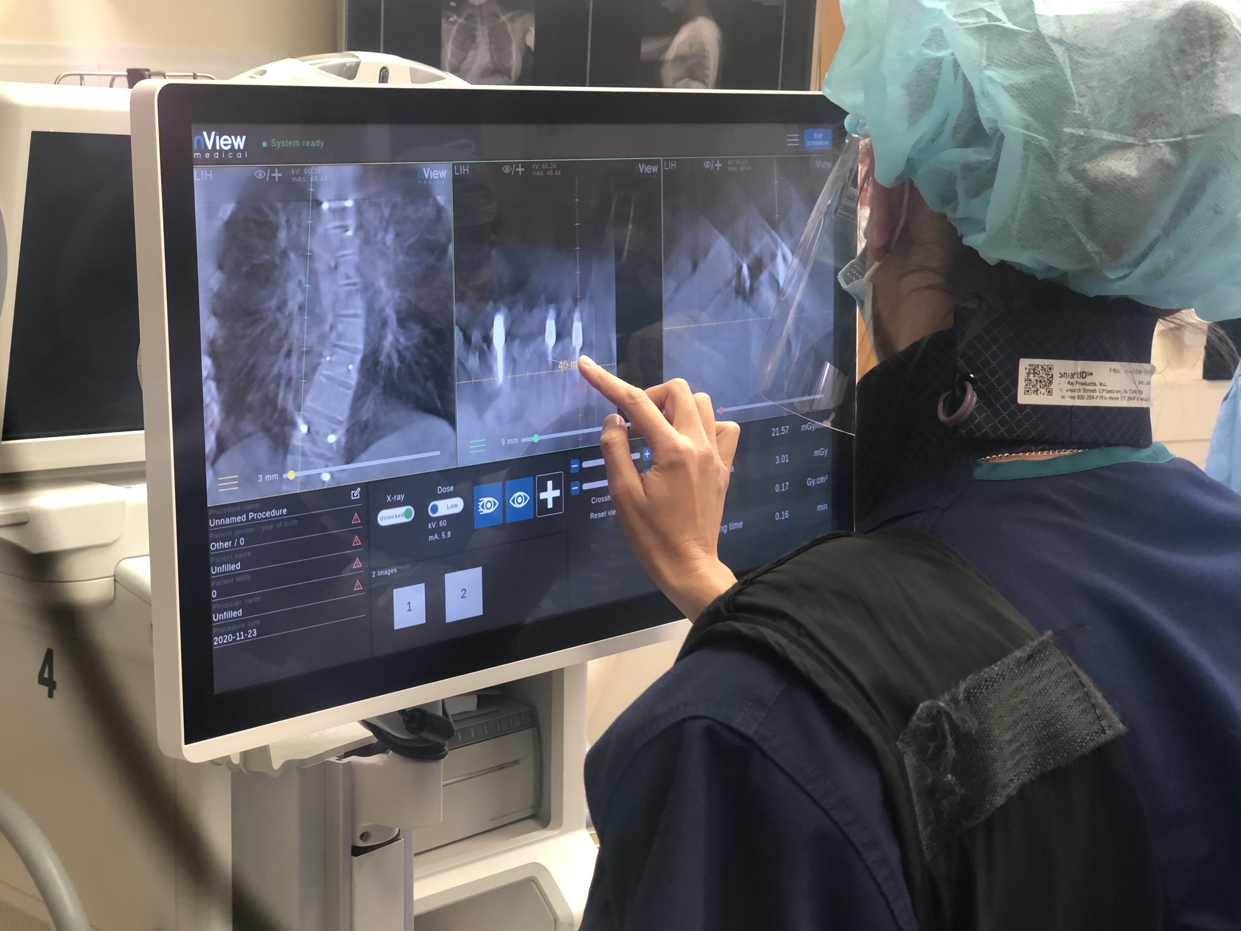 nView s1 in-use during pediatric spinal deformity procedure at Children’s National Hospital