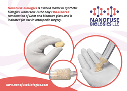 NanoFUSE Biologics is a combination of patented bioactive glass plus demineralized bone matrix (DBM)