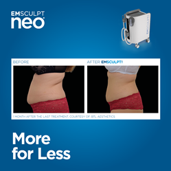 EMSCULPT NEO® is the first and only non-invasive body contouring technology to provide simultaneous muscle building and fat reduction in one convenient treatment.