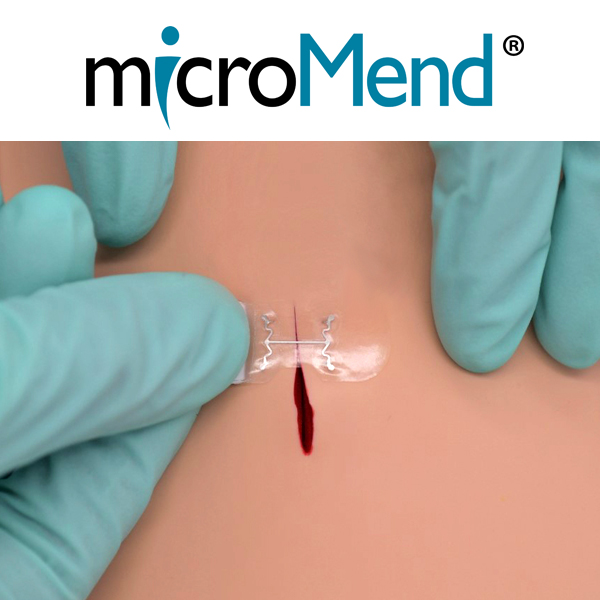 microMend Skin Closure Device