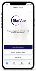 SknVue Tracker App Image