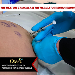 Qwo™ Injectable for Cellulite