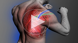 Identify Appropriate Shoulder Dysfunction Treatment