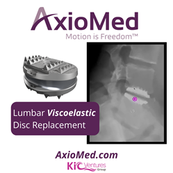 AxioMed Viscoelastic Lumbar Disc Replacement
