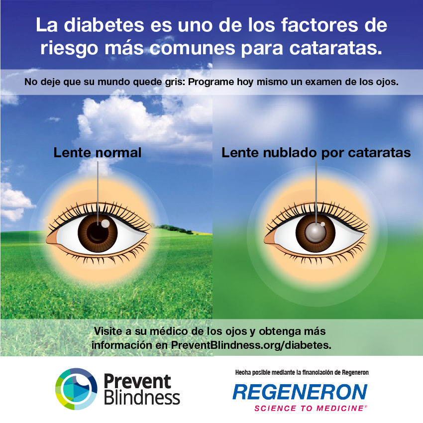 Prevent Blindness offers free educational materials, in English and Spanish, to help educate the public as part of the "Diabetes and the Eyes" program.