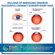 For Cataract Awareness Month in June, Prevent Blindness Provides Educational Information and Resources on the Leading Cause of Vision Loss in the United States