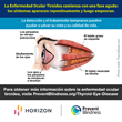 Prevent Blindness declares Third Annual Thyroid Eye Disease Awareness Week, Nov. 14-20, 2022, providing free educational materials in English and Spanish.